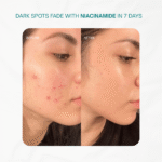 11_20250924_145153_0010